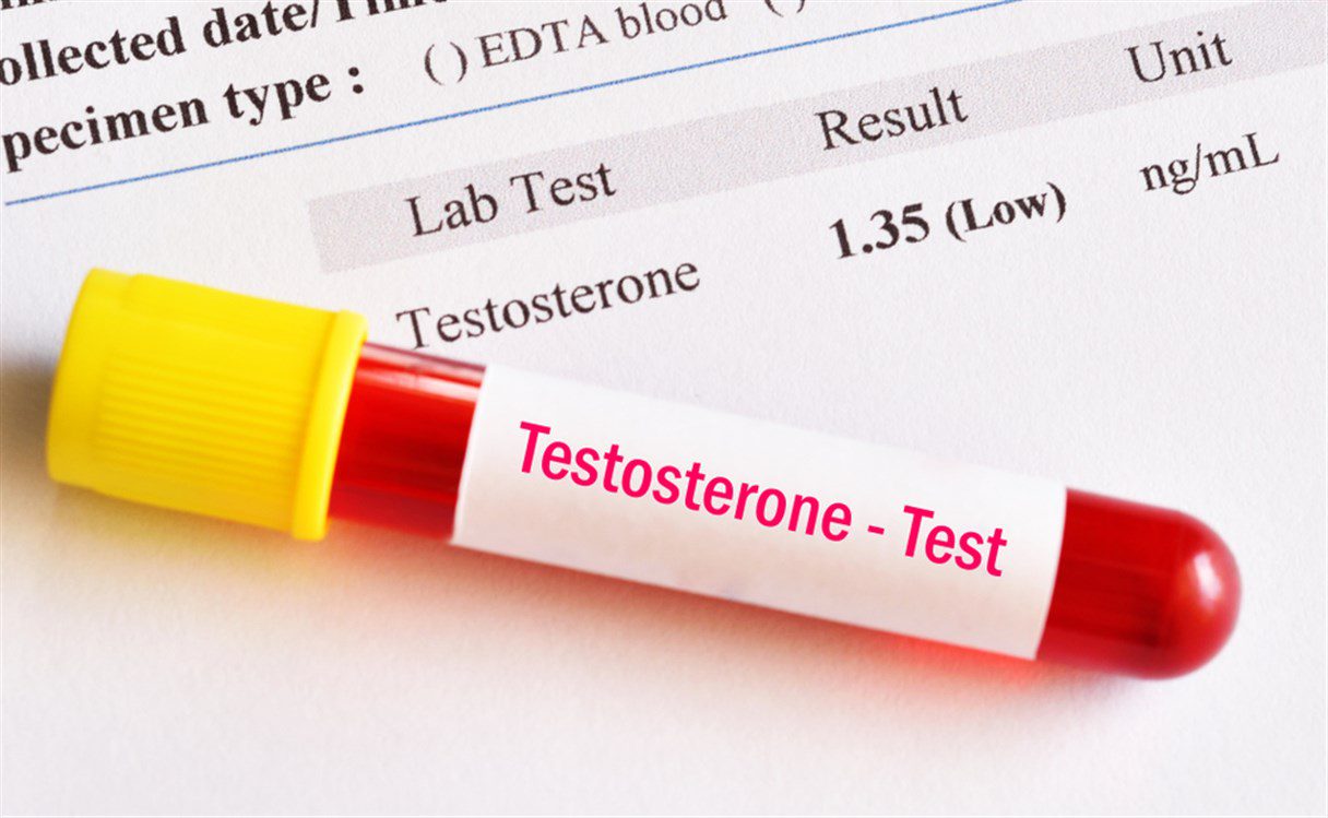 كيفية زيادة هرمون التستوستيرون عند الرجال