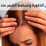 هرمون الذكورة وتساقط الشعر عند النساء